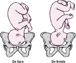 ASSISTÊNCIA AO PARTO Estática Fetal