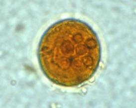 28. Assinale a alternativa que indica a figura abaixo: a) Shistosoma mansoni. b) Entamoeba coli. c) Enterobius vermicularis. d) Giárdia lamblia. 29.