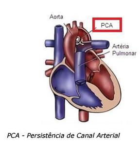 Sopros contínuos comumente ocorrem quando a aorta ou uma artéria sistêmica comunica com uma artéria, uma câmara