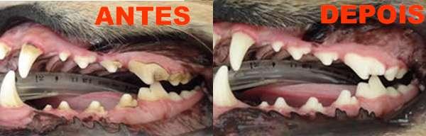 Dentes