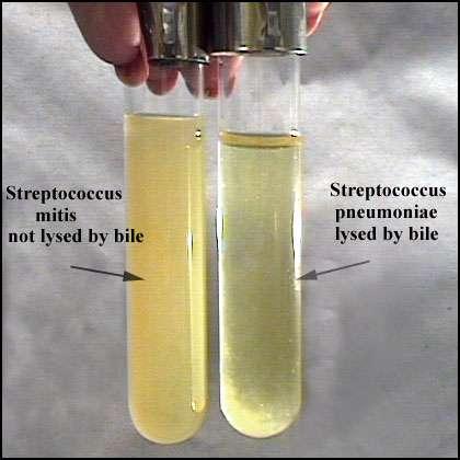 Bile Emulsificação de gorduras Excretas de