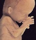 Sétima Semana Com 7 a 8 SEMANAS de gestação, o embrião é capaz de realizar movimentos muito simples. Lábio superior está completo e o nariz é mais proeminente.