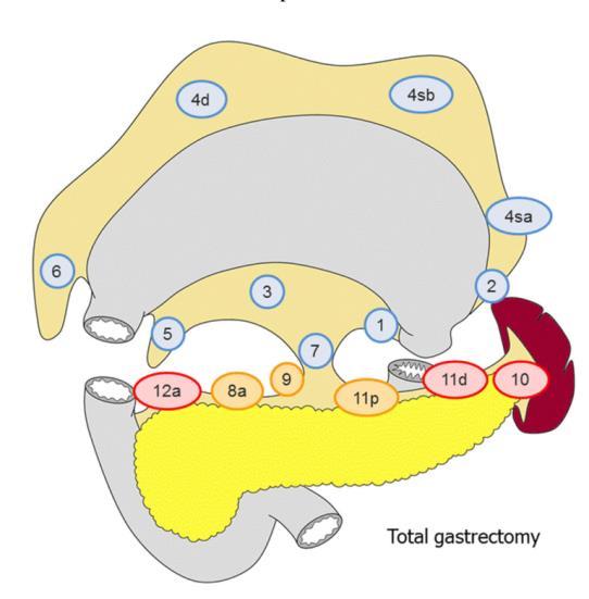 Método 13 A B A. Gastrectomia total; B. Gastrectomia distal. Adaptado de JGCTG Japanese Gastric Cancer Treatment Guidelines 6, 29 Figura 4 - Estações linfonodais gástricas 3.5.