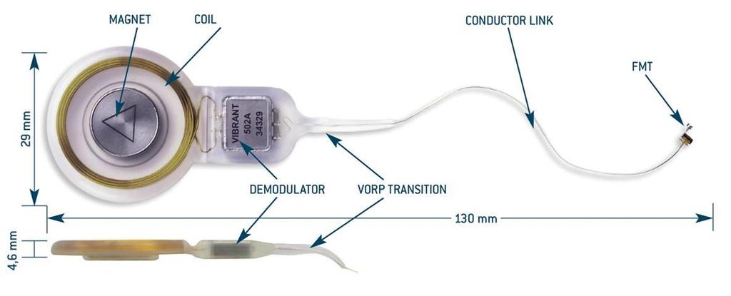 4 Método 41 Figura 3 - Detalhes do componente implantável Figura 4 - Detalhes para o transdutor de massa flutuante (FMT) O protocolo cirúrgico utilizado para implantação do dispositivo Vibrant