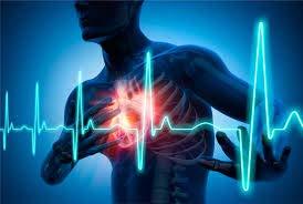 CHOQUE CARDIOGÊNCICO Falha na atividade de bombeamento do coração.