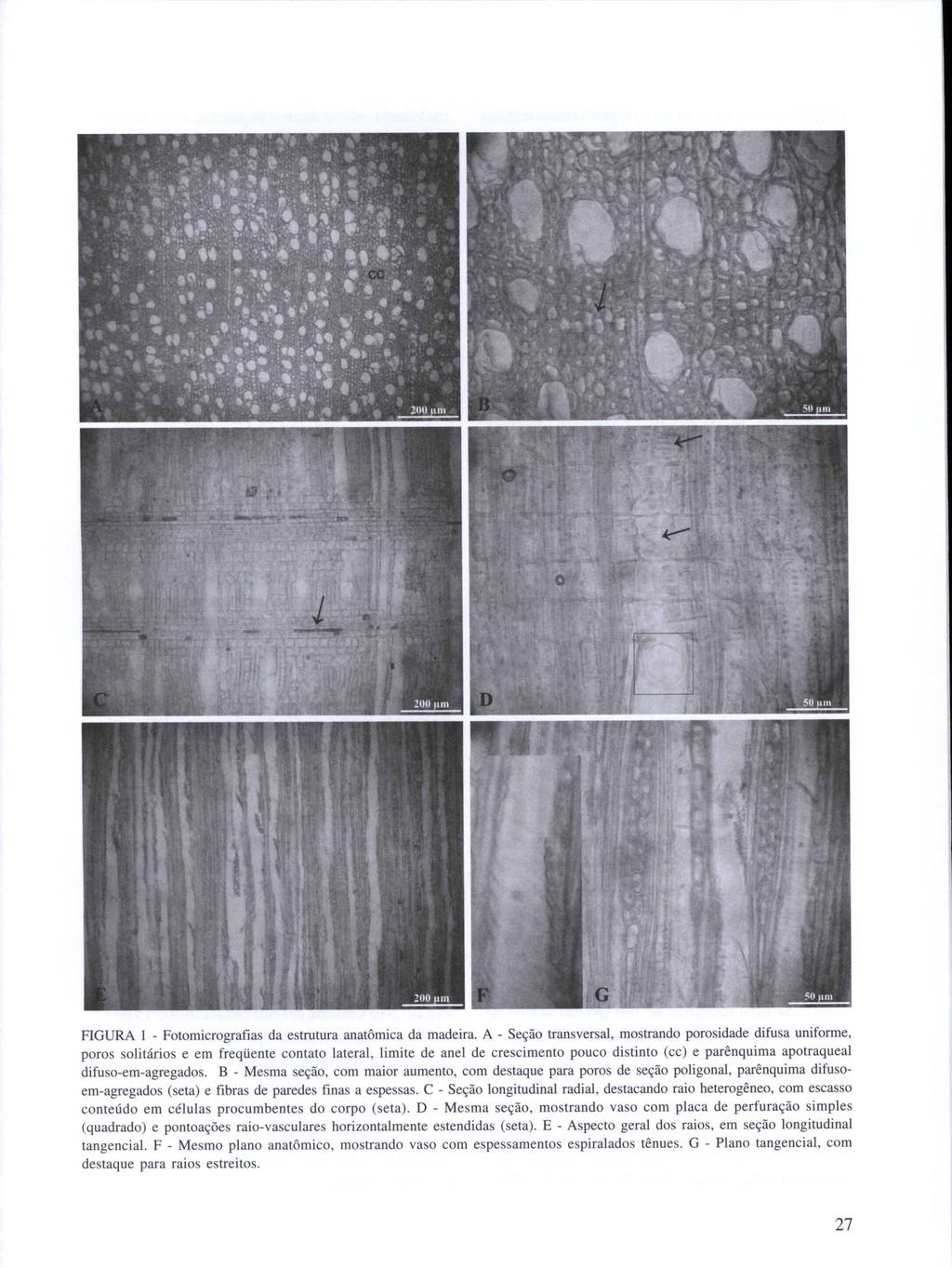 FIGURA I - Fotomicrografias da estrutura anatômica da madeira.
