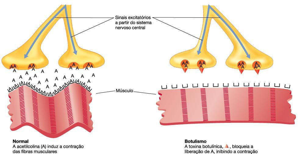 Neurotoxina Clostridium botulinum Toxina botulínica age nas junções neuromusculares e impede a transmissão de impulsos para músculo (não se contrai) - Age nas