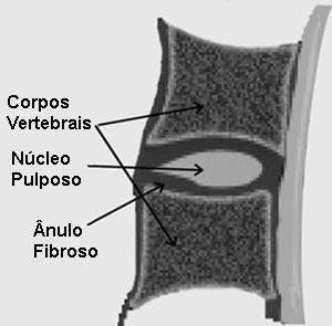 1. Introdução 1.1 O disco intervertebral O disco intervertebral é uma articulação do tipo sínfise, na qual a fibrocartilagem do disco acopla as vértebras adjacentes permitindo certa mobilidade.