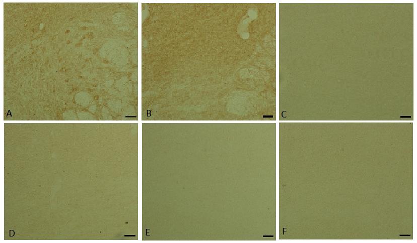 Imagem 4: Fotomicrografias da região do mesencéfalo em campo claro do encéfalo de rato do grupo BCO perfundido com paraformaldeído 2%.