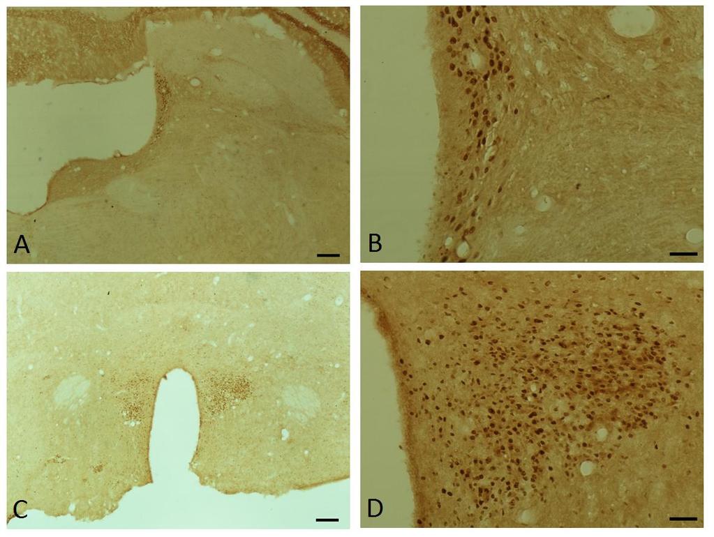 Imagem 7: Fotomicrografias em campo claro do encéfalo de rato do grupo NFC. Todos os cortes foram imunorreagidos com o receptor GABA B. Nas Figuras A e B é verificado o Locus coeruleus.