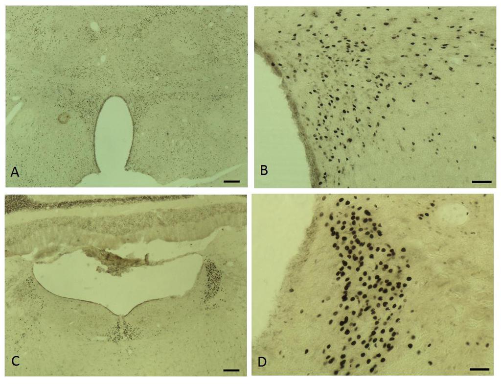 Imagem 8: Fotomicrografias em campo claro do encéfalo de rato do grupo NFC. Todos os cortes foram imunorreagidos com a proteína nuclear c-fos da marca SANTA CRUZ.