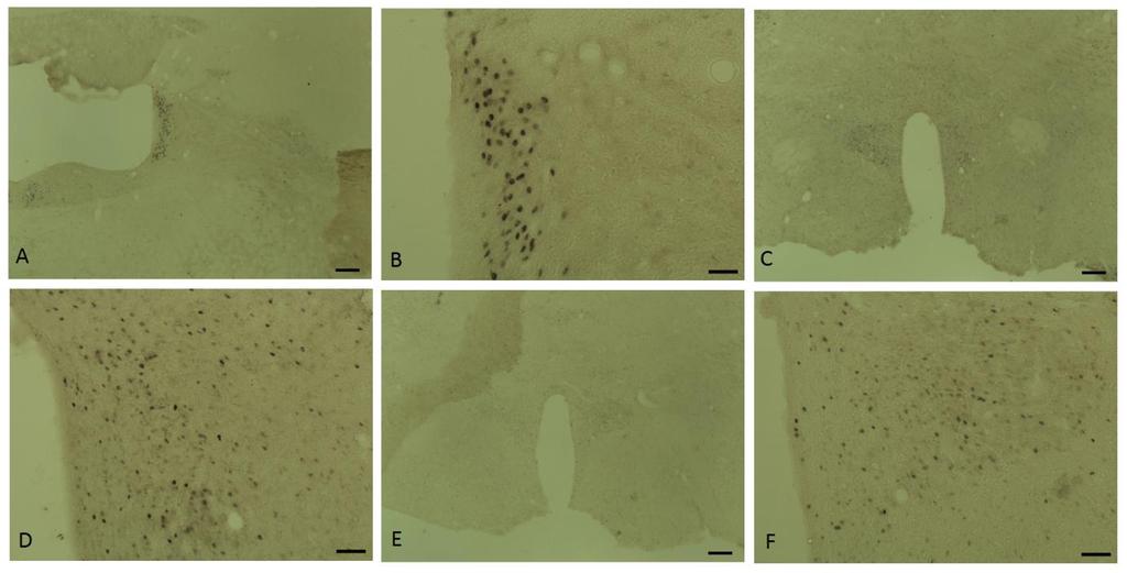 Imagem 9: Fotomicrografias em campo claro do encéfalo de rato do grupo NFC. Todos os cortes foram imunorreagidos com a proteína nuclear c-fos da marca CALBIOCHEM.