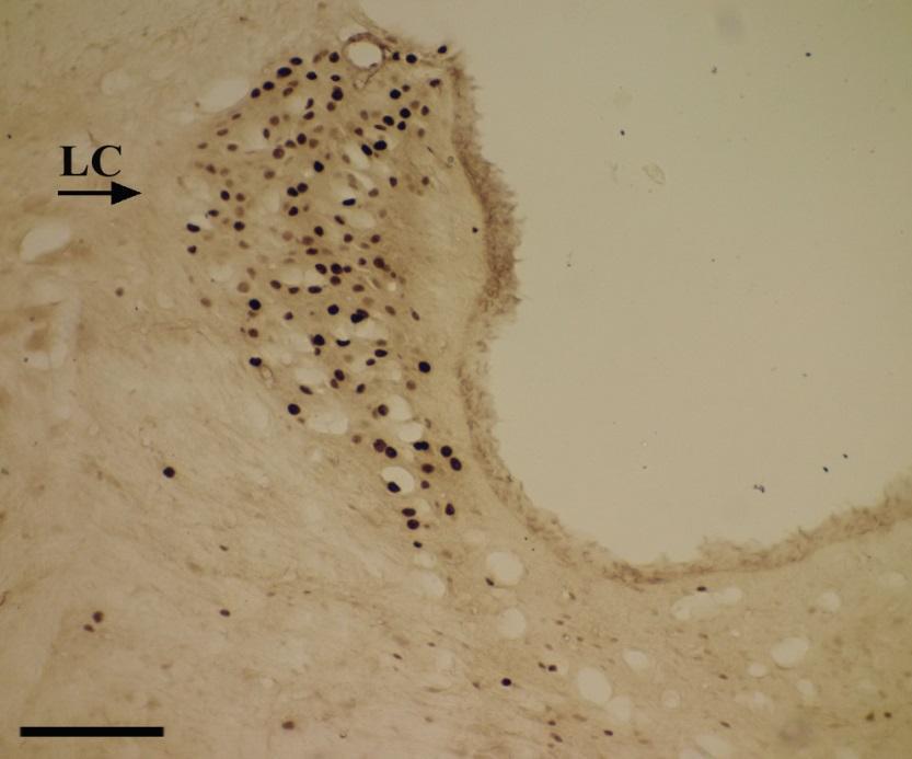 Células c-fos+ foram identificadas no Locus coeruleus (LC) e no Paraventricular do Hipotálamo (PVH) do encéfalo