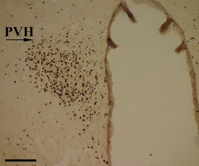 Imagem 1: Fotomicrografia de corte coronal do encéfalo de ratos nefropatas que ingeriram via intragastrica suco