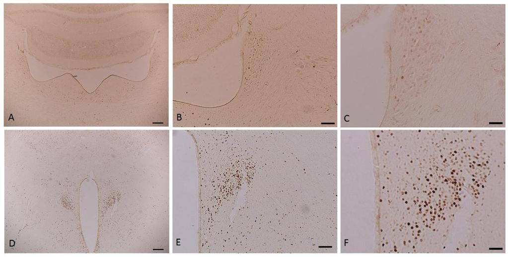 RESULTADOS Imagem 2: Fotomicrografias em campo claro do encéfalo de ratos do grupo BCO imunorreagidos com a proteína nuclear c-fos. Nas Figuras A - C os cortes verificados são do Locus coeruleus (LC).