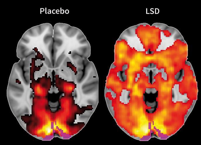 Várias regiões do cérebro são afetadas pelo LSD, mas seu mecanismo de ação atua principalmente na atividade agonista da serotonina.