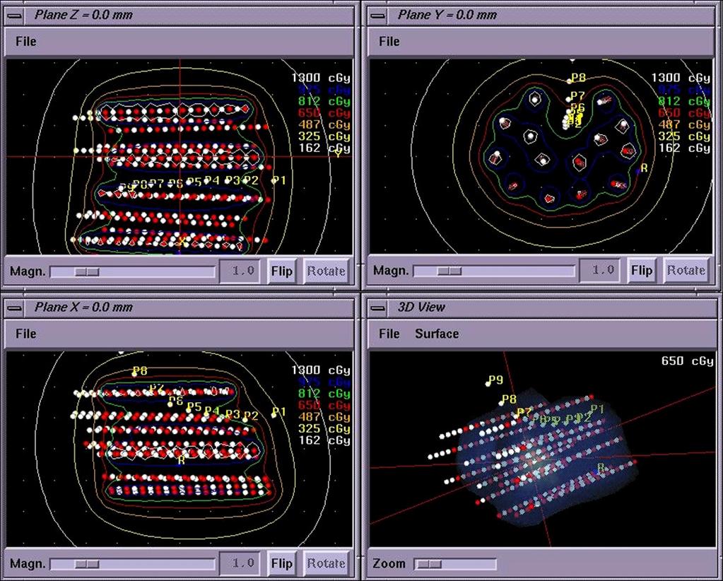 46 Figura 3 Curvas de isodose planejadas visualizadas na tela do sistema