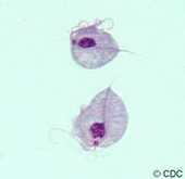 Causada pelo protozoário Tricomonas vaginalis. Sintomas na mulher: corrimento vaginal e ardor ao urinar.