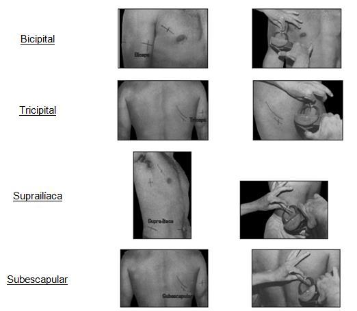 Formas de medição Pregas Adiposas Bicipital Tricipital Supra-ilíaca