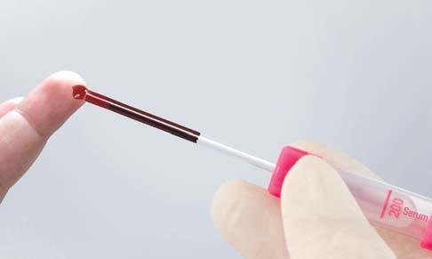 Microvette O sistema de coleta de sangue capilar de fácil manuseio