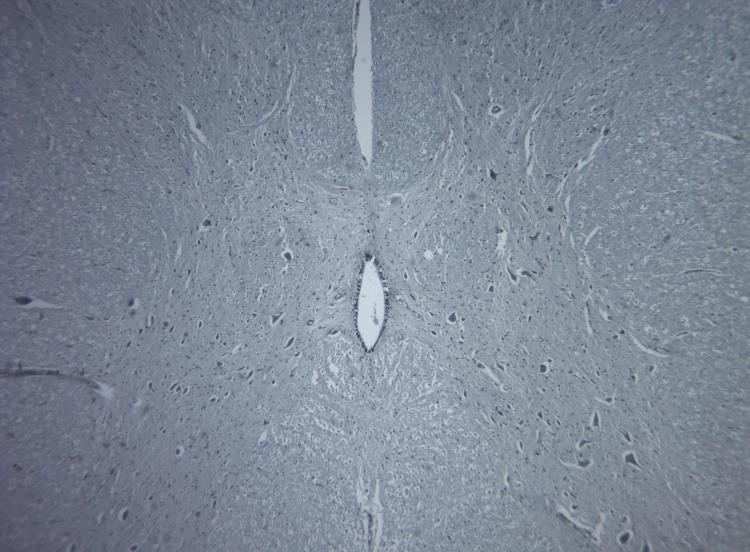 O orifício central (circulado) do H medular é o canal ependimário, revestido pelas células ependimárias, pertencentes a neuroglia.