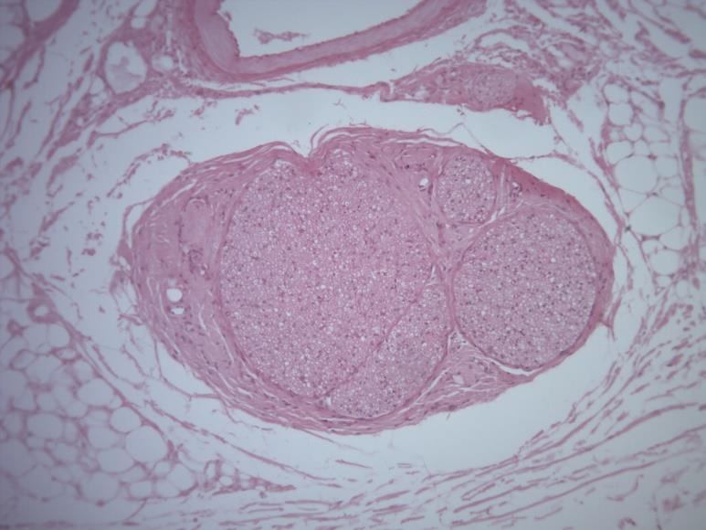 LÂMINA A7 H2 H3 TECIDO NERVOSO (SNP) VÁSCULO NERVOSO HE Nessa lâmina pode-se observar um nervo: estrutura maciça, envolta externamente por uma bainha de tecido conjuntivo denso, denominada Epineuro