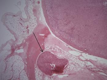 Já cada axônio e sua bainha de mielina, a qual foi produzida por células de Schwann, é envolto pelo endoneuro, uma membrana de tecido conjuntivo frouxo.