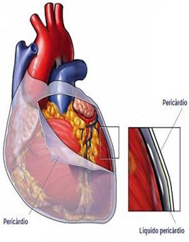 Segunda Bulha HIPERFONESE Aumento da pressão da aorta > velocidade de fechamento Aumento da pressão pulmonar > velocidade de fechamento HIPOFONESE Diminuição do débito cardíaco Miocardiopatias