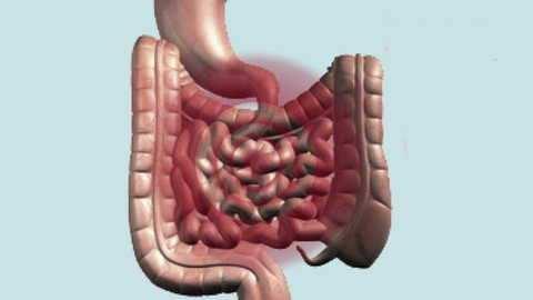 Gastroenterite Conceito: Infecção simultânea do estômago e