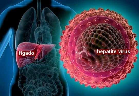 Hepatite Tratamento: Não existe tratamento específico para hepatite viral. O tratamento é feito através de repouso no leito, na fase aguda da doença, e nutrição adequada.