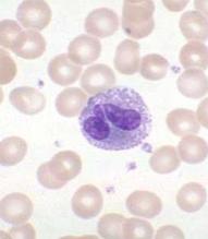 EOSINÓFILOS EOSINOCITOSE > 500/uL Parasitoses