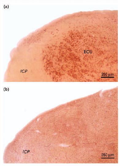 A ECU ICP B ICP Figura 2: Neurodegeneração na AEC3.