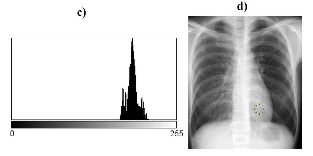 Isto foi necessário em função da expressiva diferença em termos de distribuição dos tons de cinza de uma radiografia do tórax inteira com somente da região cardíaca, demonstrada na Fig. 2.