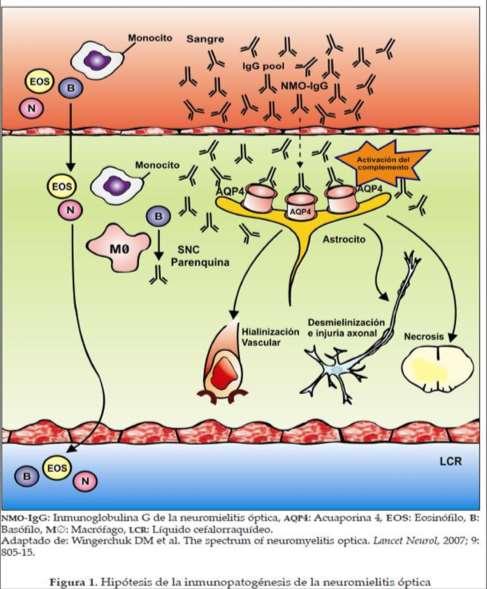 PATOGENIA DA NMO vs NMOSD Sem etiologia definitiva encontrada Predisposição genética Activação da cascata inflamatória e autoimune Imunomediada por anticorpos do sistema humoral Anticorpos NMO (AQP