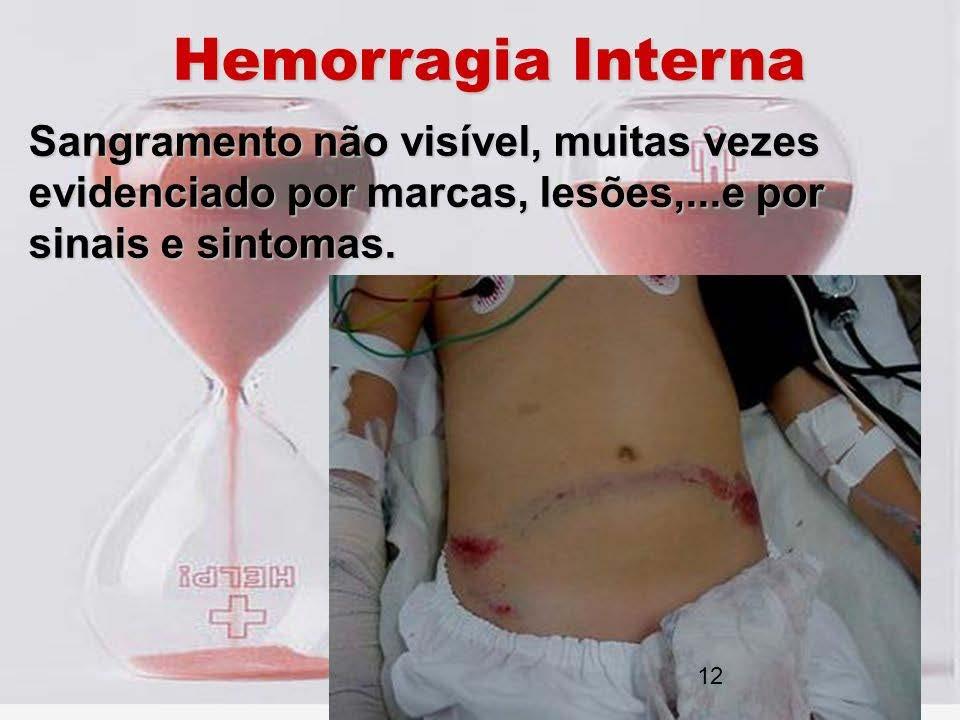 3. Hemorragia interna deve expor o abdome do paciente para inspecionar e palpar procurando sinais de lesão.