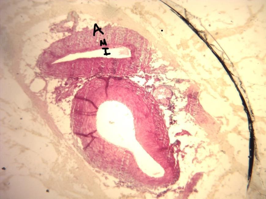 LÂMINA H4 VEIA DE MÉDIO CALIBRE Possui túnica íntima possui válvulas (dobras da intima), túnica média formada por músculo liso, fibras colágenas