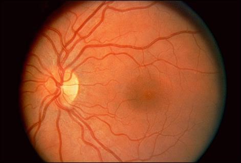 RETINA É a camada mais interna do olho. Formada por receptores especiais sensíveis a luz.