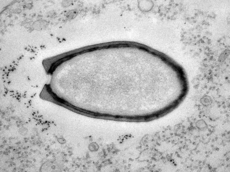 DNAfd - 1μm Pithovirus (2013)