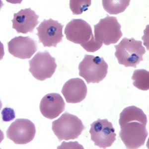 Plasmodium