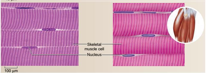 Tecido Muscular músculo estriado O músculo estriado esquelético é formado por feixes de células cilíndricas muito longas