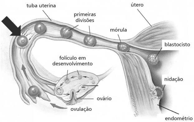 e) os gêmeos monozigóticos compartilham a mesma carga genética e são a forma mais comum de gestação múltipla na espécie humana.