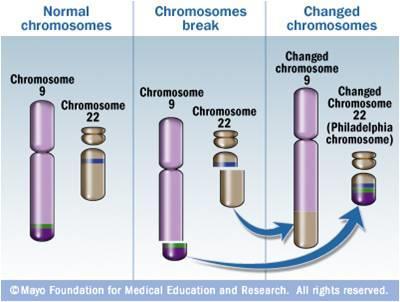 Figura 2. Cromossomo Filadélfia (Ph). Translocação recíproca entre os cromossomos 9 e 22. Fonte: sfipoporto.blogspot.com.