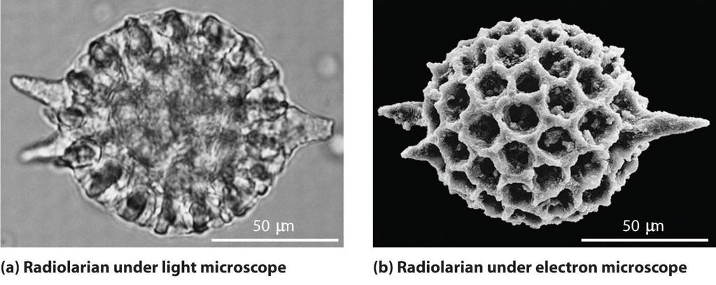Medidas utilizadas na microscopia Microscopia óptica (luz) Micrômetro (μm): 1 μm = 10-3 mm = 10-6 m (0,000001m) Microscopia eletrônica