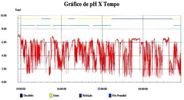 13 Quantifica o