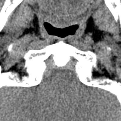 ANATOMIA TOPOGRÁFICA Espaço