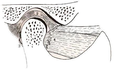 CARTILAGEM ARTICULAR DA ATM Revestem as superfícies ósseas articulares (avascular) Espessa em pontos de maior atrito: vertente posterior da