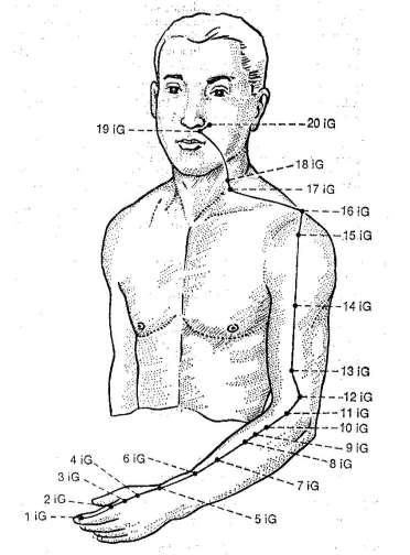 Meridiano do Intestino Grosso Yang Ming da Mão Sintomas do meridiano: dor no trajeto e dificuldade na movimentação dos músculos extensores do braço e do ombro, febre, odontalgia, garganta inchada e