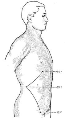 Meridiano do Fígado Jue Yin do Pé Sintomas do meridiano: impotência funcional dos músculos situados em seu trajeto, vertigem, zumbido, abdome doloroso e distendido, dor e edema dos genitais externos,