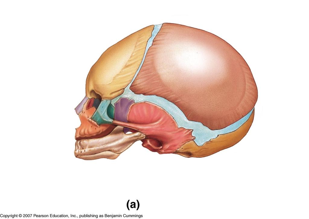 LE 6-15a Coronal suture Sphenoidal fontanel FRONTAL BONE PARIETAL BONE Squamous suture NASAL BONE