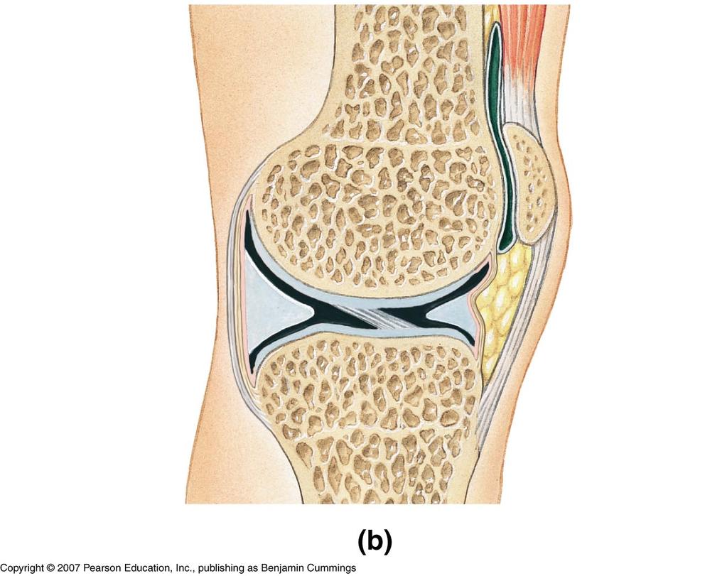 LE 6-31b Bursa Extracapsular ligament Fat pad Joint